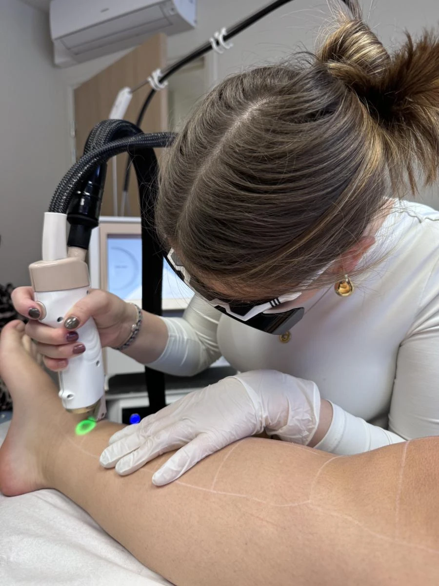 Épilation laser